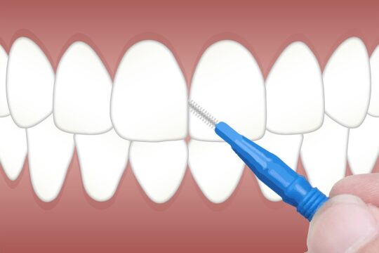 Persona cepillando los dientes con un cepillo de cerdas suaves, clave para prevenir la caries dental