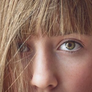 Tipos de rinoplastia abierta cerrada y ultrasonica