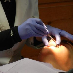 Implantes dentales inmediatos ¿funcionan igual que los tradicionales