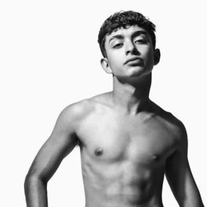 Ginecomastia en adolescentes ¿hay que preocuparse Un enfoque medico y tranquilizador