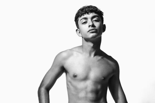 Ginecomastia en adolescentes ¿hay que preocuparse Un enfoque medico y tranquilizador