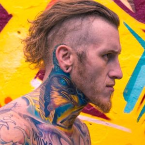 mentoplastia en hombres